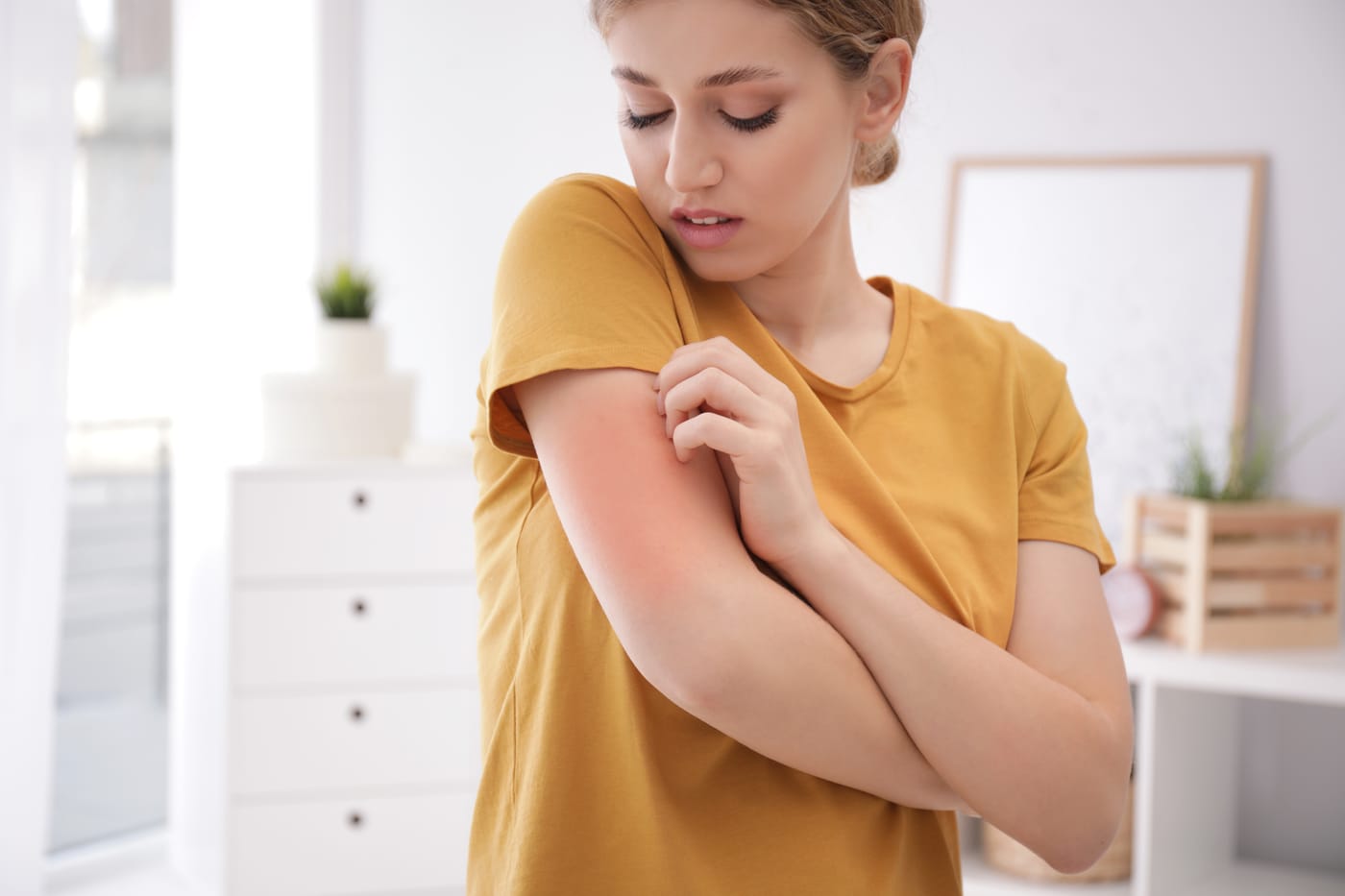 A woman scratches an itchy, reddened patch of skin on her upper arm
