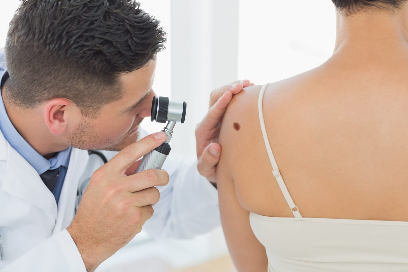 Examen con dermatoscopio de un lunar en el hombro de una mujer