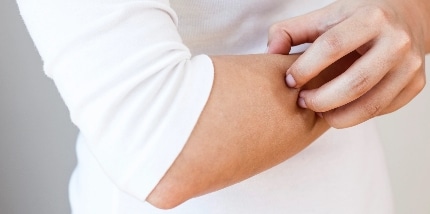 Una persona se rasca una zona de piel irritada en el brazo
