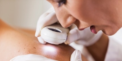 A dermatologist examines a patient's shoulder with a dermatoscope