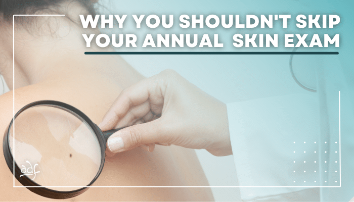 Why You Shouldn't Skip Your Annual Skin Exam