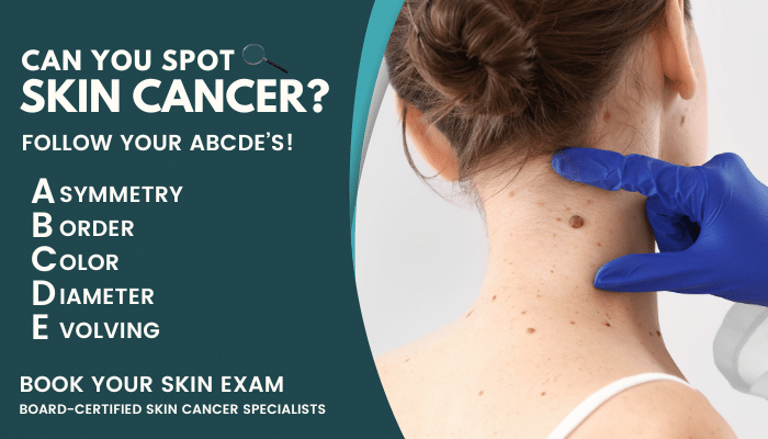ADF Skin Cancer Signs